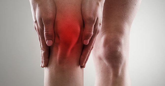 How to Treat Arthritis Pain image